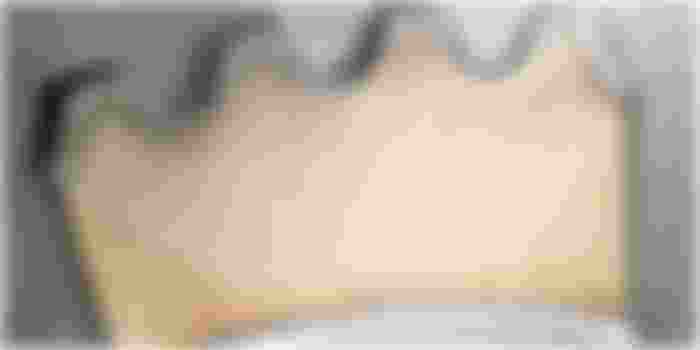 Surface Enhancement: Vacuum Carburizing, Gas Nitriding